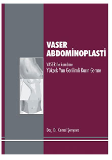 Vaser Abdominoplasti