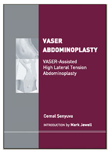 Vaser Abdominoplasti