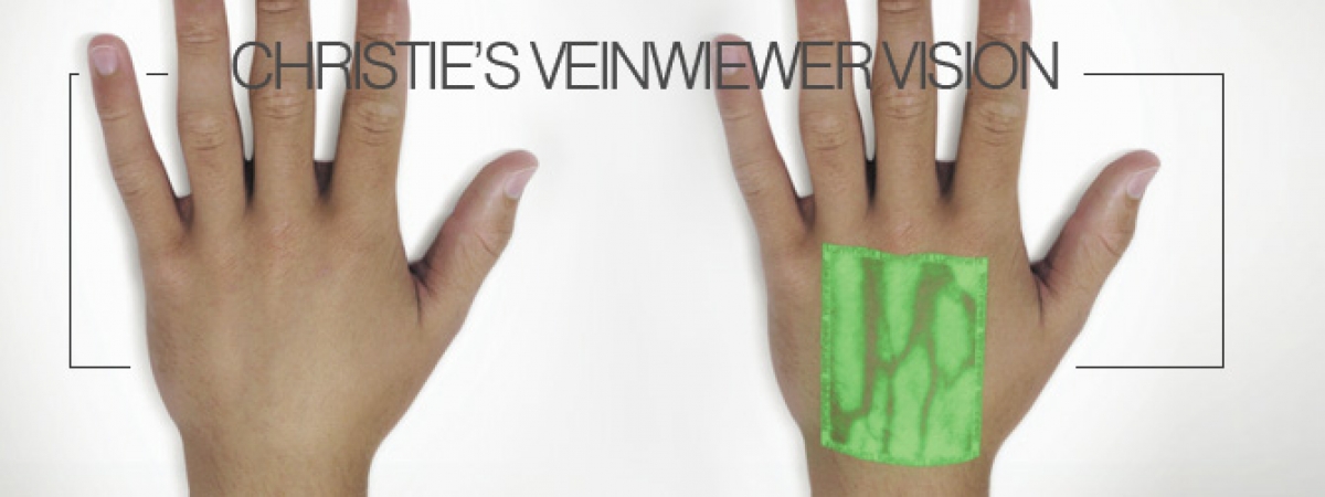 Christie&#039;s VeinWiewer Vision
