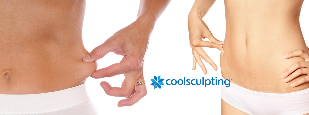 Coolsculpting